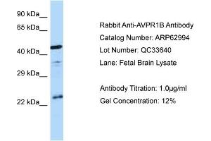Western Blotting (WB) image for anti-Arginine Vasopressin Receptor 1B (AVPR1B) (C-Term) antibody (ABIN2774358) (AVPR1B antibody  (C-Term))
