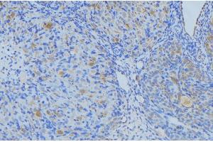 ABIN6269003 at 1/100 staining Human uterus tissue by IHC-P. (COL3A1 antibody  (N-Term))