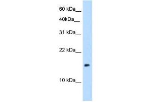 WB Suggested Anti-PAGE1 Antibody Titration:  5. (PAGE1 antibody  (Middle Region))