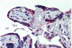 Human Placenta: Formalin-Fixed, Paraffin-Embedded (FFPE) (AAK1 antibody  (C-Term))