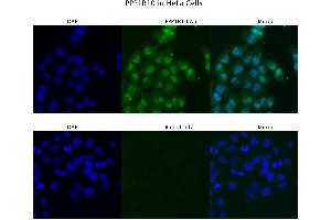 Sample Type :  HeLa   Primary Antibody Dilution:  4 ug/ml   Secondary Antibody :  Anti-rabbit Alexa 546   Secondary Antibody Dilution:  2 ug/ml   Gene Name :  PPP1R10 (PPP1R10 antibody  (N-Term))