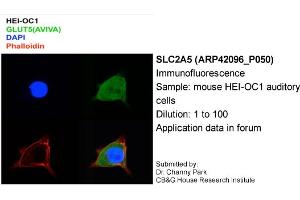 Image no. 2 for anti-Solute Carrier Family 2 (Facilitated Glucose/fructose Transporter), Member 5 (SLC2A5) (Middle Region) antibody (ABIN310280) (SLC2A5 antibody  (Middle Region))