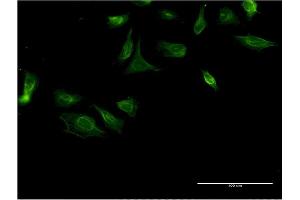 Immunofluorescence of monoclonal antibody to ITGA4 on HeLa cell. (ITGA4 antibody  (AA 98-207))