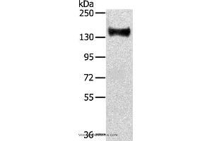 Western blot analysis of Mouse brain tissue, using RASAL2 Polyclonal Antibody at dilution of 1:350
