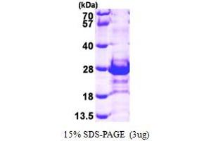 CACYBP Protein (AA 1-185) (His tag)