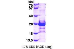 SDS-PAGE (SDS) image for Calcyclin Binding Protein (CACYBP) (AA 1-185) protein (His tag) (ABIN667003) (CACYBP Protein (AA 1-185) (His tag))