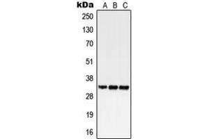 Western blot analysis of GPR18 expression in HEK293T (A), SP2/0 (B), H9C2 (C) whole cell lysates. (GPR18 antibody  (Center))