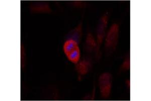 Image no. 2 for anti-Mitogen-Activated Protein Kinase Kinase 4 (MAP2K4) (Thr261) antibody (ABIN197323) (MAP2K4 antibody  (Thr261))