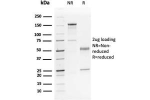 SDS-PAGE Analysis Purified p63 Mouse Monoclonal Antibody (TP63/2428). (p63 antibody)