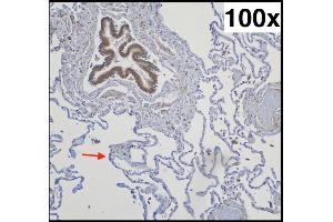 Typical pulmonal findings in AQP-5 (aquaporin-5) immunohistochemistry (right lower lobe, 73-year-old woman with chronic emphysema): Strongly positive bronchial epithelium (upper left corner) next to negative pneumocytes type I (exemplary marked with an arrow) Source: PMID34181078 (Aquaporin 5 antibody  (AA 201-265) (Biotin))