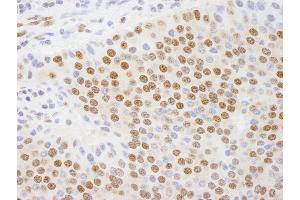 Immunohistochemistry (IHC) image for anti-C-terminal Binding Protein 1 (CTBP1) (AA 400-440) antibody (ABIN7448499) (CTBP1 antibody  (AA 400-440))