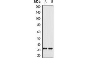 Western blot analysis of WBSCR22 expression in H460 (A), A549 (B) whole cell lysates.