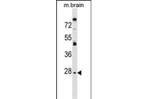 AQP1 Antibody (C-term) (ABIN1536913 and ABIN2849410) western blot analysis in mouse brain tissue lysates (35 μg/lane). (Aquaporin 1 antibody  (C-Term))