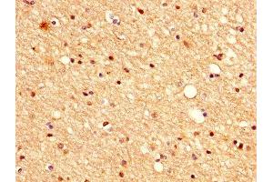 IHC image of ABIN7175396 diluted at 1:500 and staining in paraffin-embedded human brain tissue performed on a Leica BondTM system. (VASH1 antibody  (AA 1-204))