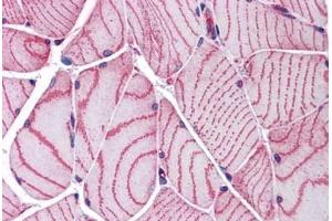 Human Skeletal Muscle: Formalin-Fixed, Paraffin-Embedded (FFPE) (ACTN2 antibody  (AA 215-500))