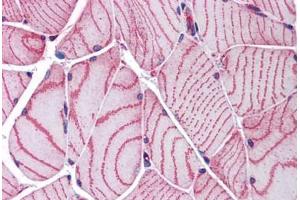 Human Skeletal Muscle: Formalin-Fixed, Paraffin-Embedded (FFPE) (ACTN2 antibody  (AA 215-500))