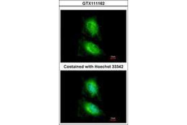 IB2 antibody  (AA 579-774)