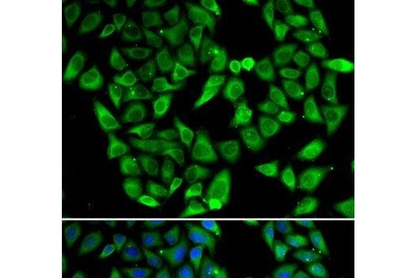 ASIP antibody