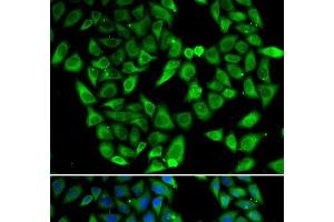 Immunofluorescence analysis of HeLa cells using ASIP Polyclonal Antibody (ASIP antibody)