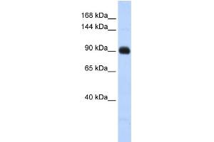 WB Suggested Anti-MATN2 Antibody Titration: 0. (MATN2 antibody  (Middle Region))