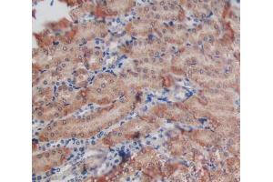 Used in DAB staining on fromalin fixed paraffin- embedded kidney tissue (GALNS antibody  (AA 168-377))