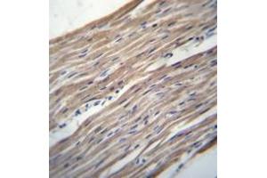 Immunohistochemistry analysis in formalin fixed and paraffin embedded human heart tissue reacted with HRC / HCR Antibody (Center) followed which was peroxidase conjugated to the secondary antibody and followed by DAB staining. (HRC antibody  (Middle Region))