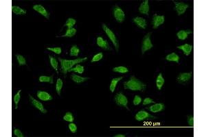 Immunofluorescence (IF) image for anti-SH3-Domain Binding Protein 5 (SH3BP5) (AA 4-112) antibody (ABIN564087)