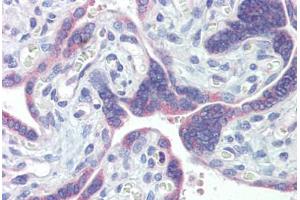 Placenta, Human: Formalin-Fixed, Paraffin-Embedded (FFPE) (PDIA3 antibody)