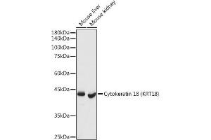 Western Blotting (WB) image for anti-Keratin 18 (KRT18) (AA 127-430) antibody (ABIN7268098)