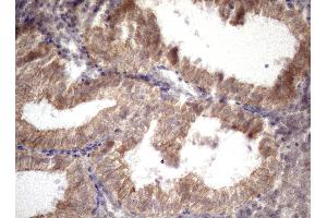 Immunohistochemistry (IHC) image for anti-Amelotin (AMTN) antibody (ABIN2716038) (Amelotin antibody)