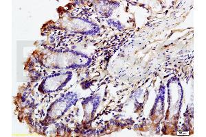 Formalin-fixed and paraffin embedded mouse intestine labeled with Rabbit Anti phospho-GCN2 (Thr667) Polyclonal Antibody, Unconjugated (ABIN684958) at 1:200 followed by conjugation to the secondary antibody and DAB staining (GCN2 antibody  (pThr667))