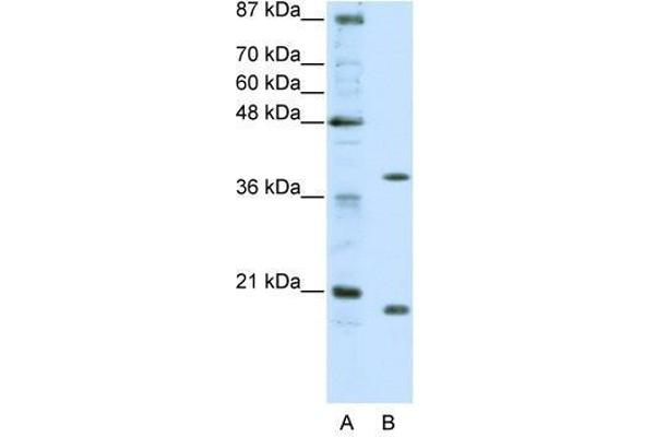 ZNF322A antibody  (C-Term)