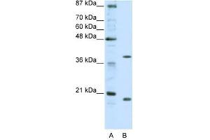 ZNF322A antibody used at 0. (ZNF322A antibody  (C-Term))