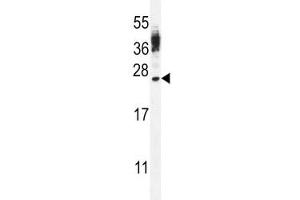 CT45A antibody western blot analysis in WiDr lysate (CT45A3 antibody  (AA 106-135))