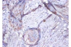 Immunohistochemistry of paraffin-embedded human prostate tissue using ABIN7154292 at dilution of 1:100 (GOLM1 antibody  (AA 36-401))