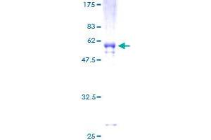 VDAC2 Protein (AA 1-294) (GST tag)