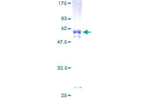 VDAC2 Protein (AA 1-294) (GST tag)