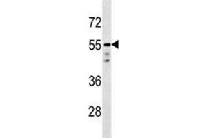 AKT1 antibody western blot analysis in T47D lysate (AKT1 antibody  (AA 438-468))