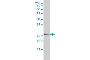 ORM1 monoclonal antibody (M01), clone 2F9-1F10 Western Blot analysis of ORM1 expression in MCF-7 . (ORM1 antibody  (AA 18-201))