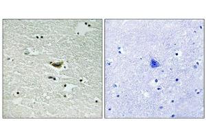 Immunohistochemical analysis of paraffin-embedded human brain tissue using CK-1α (Phospho-Tyr294) antibody (left)or the same antibody preincubated with blocking peptide (right). (CSNK1A1 antibody  (pTyr294))