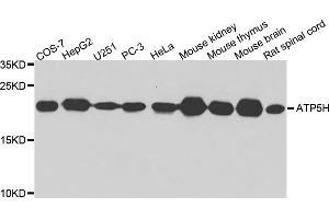Western blot analysis of extract of various cells, using ATP5H antibody. (ATP5H antibody)