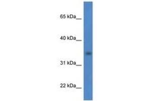 Image no. 1 for anti-Hydroxysteroid Dehydrogenase Like 1 (HSDL1) (AA 98-147) antibody (ABIN6746872) (HSDL1 antibody  (AA 98-147))
