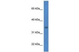 HSDL1 antibody  (AA 98-147)