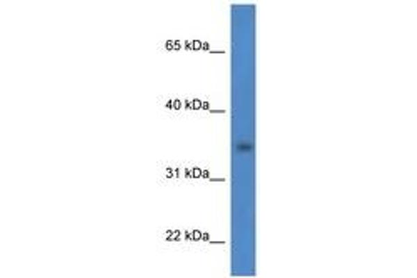 HSDL1 antibody  (AA 98-147)