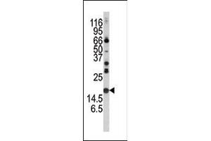 Western blot analysis of anti-Alpha-synuclein Pab in mouse brain tissue lysate. (SNCA antibody  (C-Term))