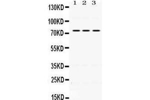 Western Blotting (WB) image for anti-Interleukin 2 Receptor, beta (IL2RB) (AA 503-539), (C-Term) antibody (ABIN3043246)