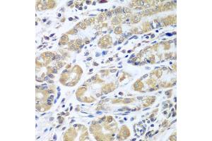 Immunohistochemistry of paraffin-embedded human stomach using EIF1AX antibody (ABIN5973507) at dilution of 1/100 (40x lens).
