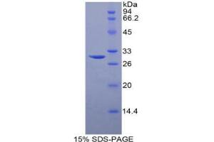 SDS-PAGE analysis of Human Sphingosine Kinase 1 Protein.