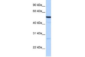 REEP4 antibody used at 1 ug/ml to detect target protein. (Receptor Accessory Protein 4 antibody  (N-Term))