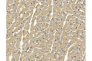 ABIN7096925 and ABIN7100991 at 1/100 staining rat heart tissue by IHC-P. (CLN8 antibody)